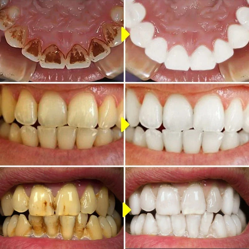 Sp4 Fresh Breath Toothpaste